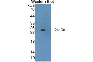 Detection of Recombinant APOB, Rat using Polyclonal Antibody to Apolipoprotein B (APOB) (APOB antibody  (AA 2747-2913))