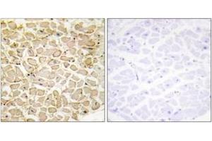 Immunohistochemistry analysis of paraffin-embedded human heart tissue, using CDH13 Antibody. (Cadherin 13 antibody  (AA 331-380))