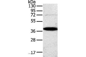 Western blot analysis of A375 cell, using SPARC Polyclonal Antibody at dilution of 1:500
