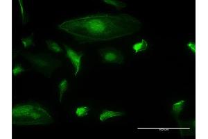 Immunofluorescence of monoclonal antibody to TRIM17 on HeLa cell. (TRIM17 / RNF16 antibody  (AA 75-184))