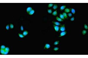 Immunofluorescent analysis of PC-3 cells using ABIN7155274 at dilution of 1:100 and Alexa Fluor 488-congugated AffiniPure Goat Anti-Rabbit IgG(H+L) (KAT5 antibody  (AA 3-512))