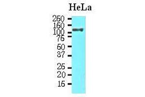 Western Blotting (WB) image for anti-Heat Shock 105kDa/110kDa Protein 1 (HSPH1) (AA 1-858), (Isoform alpha), (N-Term) antibody (ABIN263997) (HSPH1 antibody  (Isoform alpha, N-Term))