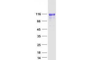 Western Blotting (WB) image for Polymeric Immunoglobulin Receptor (PIGR) protein (Myc-DYKDDDDK Tag) (ABIN2728891)