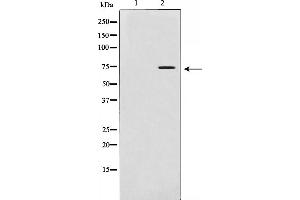 Western blot analysis of MMP 2 expression in LOVO cells. (MMP2 antibody)