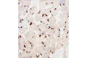 Immunohistochemical staining of paraffin-embedded human skeletal muscle section reacted with PPARA monoclonal antibody  at 1:25 dilution.