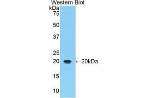 Western blot analysis of the recombinant protein. (ALOX5 antibody  (AA 374-536))