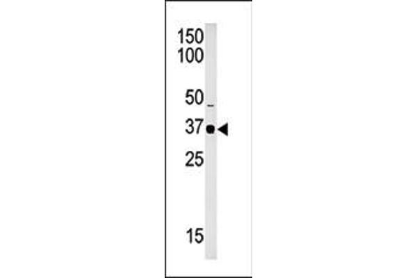 SET7 antibody  (C-Term)