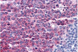 ABIN185573 (3. (Stathmin 1 antibody  (C-Term))