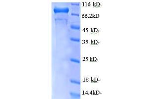 SDS-PAGE (SDS) image for GDP Dissociation Inhibitor 2 (GDI2) (AA 1-441), (partial) protein (GST tag) (ABIN5712095) (GDI2 Protein (AA 1-441, partial) (GST tag))