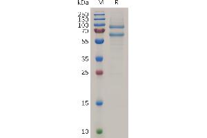 ADAM Metallopeptidase Domain 8 (ADAM8) (AA 17-655) protein (His tag)