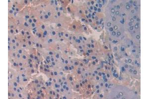 DAB staining on IHC-P; Samples: Rat Adrenal gland Tissue (PIGR antibody  (AA 343-447))