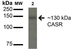 Western blot analysis of Rat Kidney cell lysates showing detection of 130kDa Calcium Sensing Receptor protein using Rabbit Anti-Calcium Sensing Receptor Polyclonal Antibody . (CASR antibody  (AA 1-100) (Biotin))