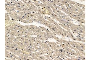 ABIN7094352 and ABIN7098399 at 1/100 staining rat heart tissue by IHC-P.