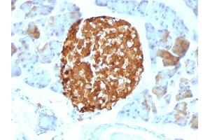 Immunohistochemistry (IHC) image for anti-Chromogranin A (CHGA) antibody (ABIN6939126)