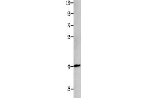 Western Blotting (WB) image for anti-Melanoma Antigen Family B, 4 (MAGEB4) antibody (ABIN2421819)