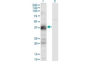 Endothelin-1 Receptor antibody  (AA 18-80)