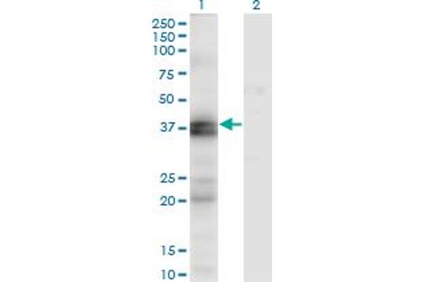 Endothelin-1 Receptor anticorps  (AA 18-80)
