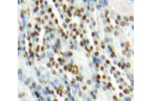 Used in DAB staining on fromalin fixed paraffin-embedded Kidney tissue (MAPK7 antibody  (AA 560-793))