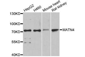 Western blot analysis of extracts of various cell lines, using MATN4 antibody. (MATN4 antibody)