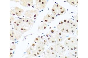 RAB3IP antibody