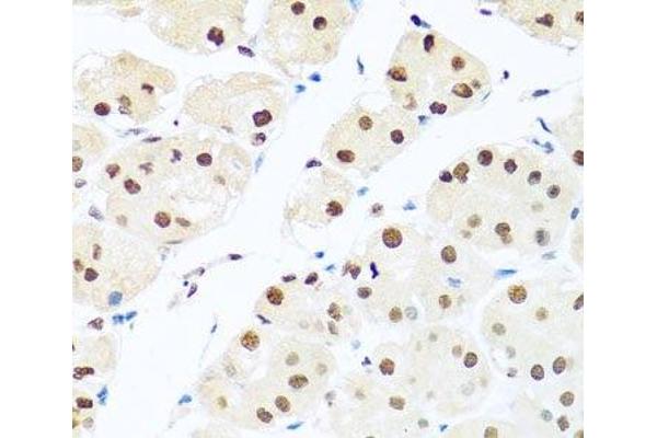 RAB3IP antibody