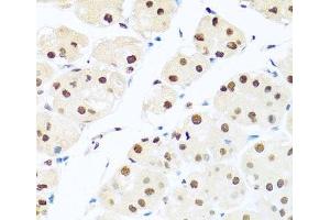 Immunohistochemistry of paraffin-embedded Human stomach using RAB3IP Polyclonal Antibody at dilution of 1:100 (40x lens).
