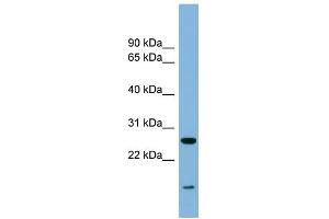 WB Suggested Anti-TRAPPC4 Antibody Titration: 0.