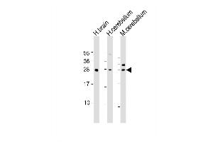 Western Blot at 1:1000-1:2000 dilution Lane 1: human brain lysate Lane 2: human cerebellum lysate Lane 3: mouse cerebellum lysate Lysates/proteins at 20 ug per lane. (KCTD11 antibody  (AA 21-53))