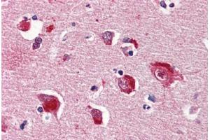 Human Brain, Cortex (formalin-fixed, paraffin-embedded) stained with PPP1CA antibody ABIN364338 at 5 ug/ml followed by biotinylated anti-mouse IgG secondary antibody ABIN481714, alkaline phosphatase-streptavidin and chromogen.