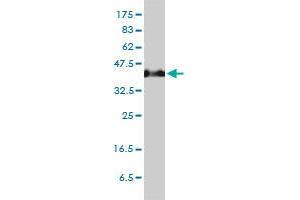 Image no. 1 for anti-Serpin Family H Member 1 (SERPINH1) (AA 1-419) antibody (ABIN465945) (SERPINH1 antibody  (AA 1-419))