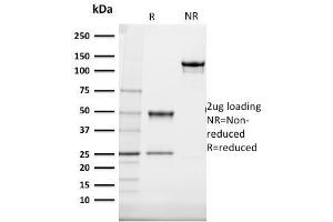 SDS-PAGE Analysis Purified Cytokeratin 20 (KRT20) Mouse Monoclonal Antibody (SPM140). (KRT20 antibody  (AA 196-323))