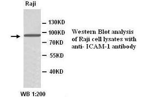 Image no. 1 for anti-Intercellular Adhesion Molecule 1 (ICAM1) antibody (ABIN790962) (ICAM1 antibody)