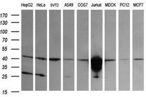 Image no. 2 for anti-T-cell surface glycoprotein CD1c (CD1C) antibody (ABIN1497192) (CD1c antibody)