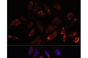 Immunofluorescence analysis of U-2 OS cells using MRPL23 Polyclonal Antibody at dilution of 1:100. (MRPL23 antibody)