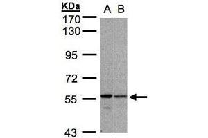 WB Image Sample (30μg whole cell lysate) A:H1299 B:MOLT4 , 7. (PRP19 antibody)