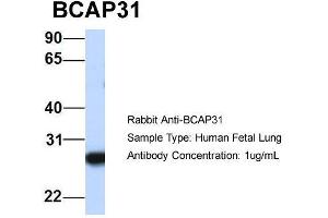 Host:  Rabbit  Target Name:  BCAP31  Sample Type:  Human Fetal Lung  Antibody Dilution:  1. (BCAP31 antibody  (Middle Region))
