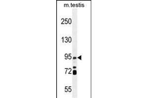 Western Blotting (WB) image for anti-Intraflagellar Transport 88 Homolog (IFT88) (AA 791-820), (C-Term) antibody (ABIN655090)