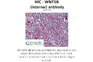 Image no. 3 for anti-Wingless-Type MMTV Integration Site Family, Member 5B (WNT5B) (Internal Region) antibody (ABIN1740832) (WNT5B antibody  (Internal Region))
