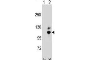Western Blotting (WB) image for anti-Guanine Nucleotide Binding Protein Like Protein 2 (GNL2) antibody (ABIN2998762) (GNL2 antibody)