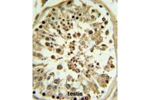 Immunohistochemistry (IHC) image for anti-Apolipoprotein L, 4 (APOL4) antibody (ABIN3002795) (Apolipoprotein L 4 antibody)