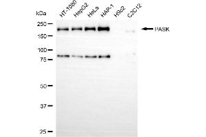 anti-PAS Domain Containing Serine/threonine Kinase (PASK) antibody