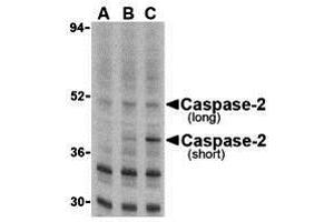 Immunohistochemistry (IHC) image for anti-Caspase 2, Apoptosis-Related Cysteine Peptidase (CASP2) (N-Term) antibody (ABIN1031296) (Caspase 2 antibody  (N-Term))