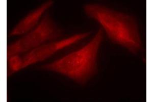 Immunofluorescence staining of methanol-fixed HeLa cells using Phospho-G3BP1-S232 antibody (ABIN2988019). (G3BP1 antibody  (pSer232))