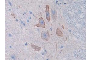 DAB staining on IHC-P; Samples: Rat Spinal cord Tissue (SPTAN1 antibody  (AA 1571-1712))