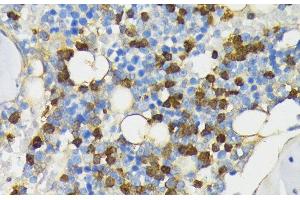 Immunohistochemistry of paraffin-embedded Rat bone marrow using CAMP Polyclonal Antibody at dilution of 1:200 (40x lens). (Cathelicidin antibody)