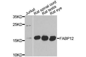 Western blot analysis of extracts of various cell lines, using FABP12 antibody (ABIN6003626) at 1/1000 dilution. (FABP12 antibody)