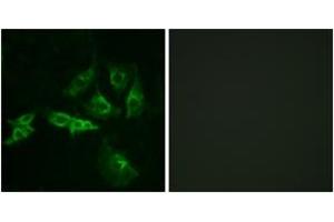 Immunofluorescence analysis of A549 cells, using GNRHR Antibody.