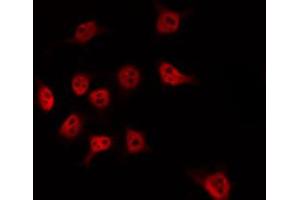 ABIN6274525 staining HT29 by IF/ICC. (MED17 antibody  (Internal Region))