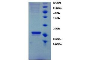Transthyretin (TTR) (AA 21-147) protein (His tag) expressed in mammalien cells
