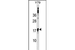 BCL7B Antibody (C-term) (ABIN1536707 and ABIN2848811) western blot analysis in Y79 cell line lysates (35 μg/lane).